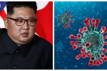 Intelijen AS Sebut Kim Jong Un Kritis Usai Operasi
