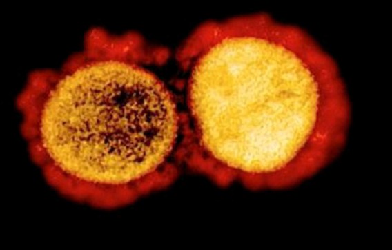 Peneliti China Beberkan 30 Mutasi Baru Virus Corona