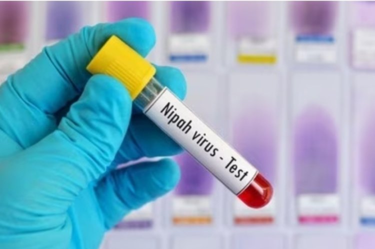 Virus Nipah di India Tewaskan 2 Orang, Epidemiolog Sebut Pentingnya Deteksi Dini