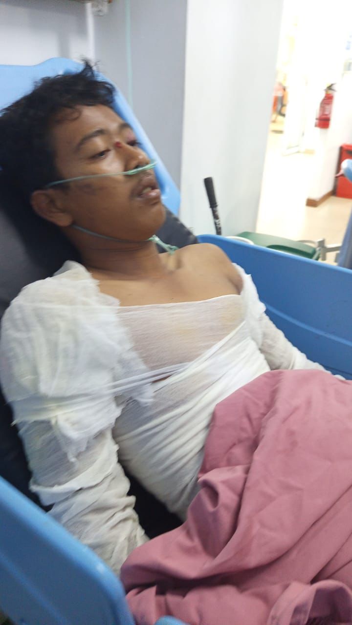 Pasang Kabel Internet, Separuh Tubuh Fathier Hangus Disetrum Listrik, DPRD Pekanbaru Desak My Republic Bertanggung Jawab